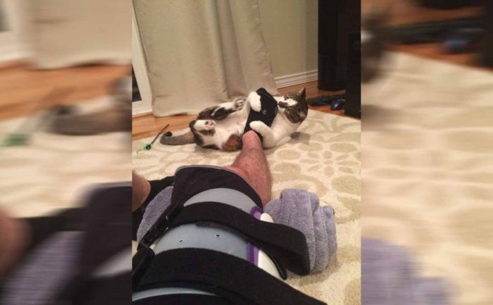A cat playing with the foot of a man wearing a cast on his thigh and knee 