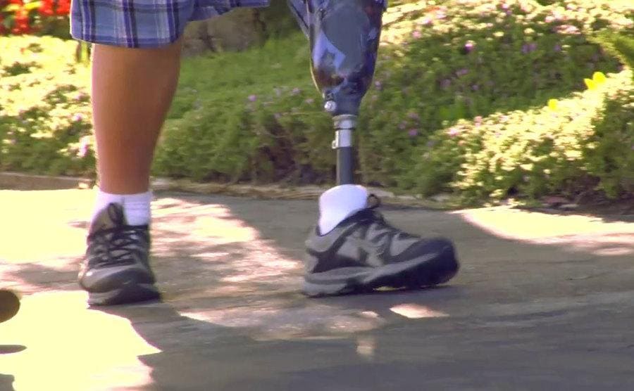 A close up photograph of Loren walking with his prosthetic leg on.