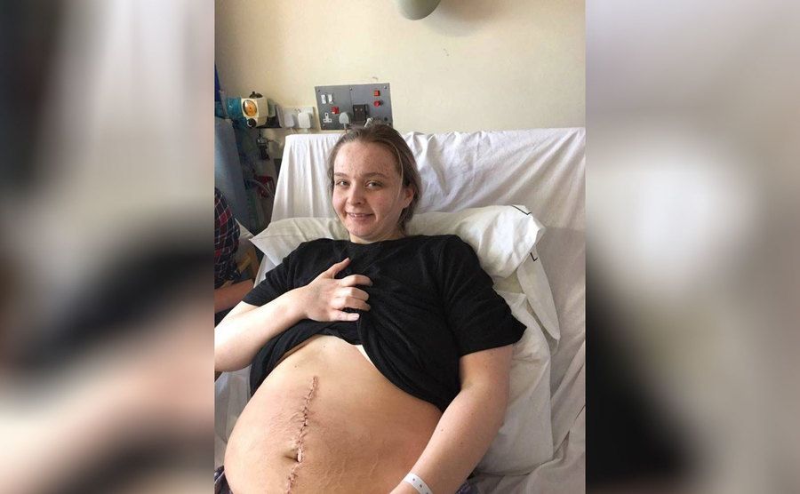 Keely Favell in the hospital bed with a large scar down her stomach