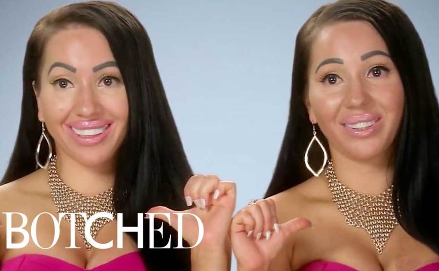 Anna and Lucy talk about their botched plastic surgery. 